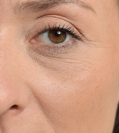 Before — drugstore foundation