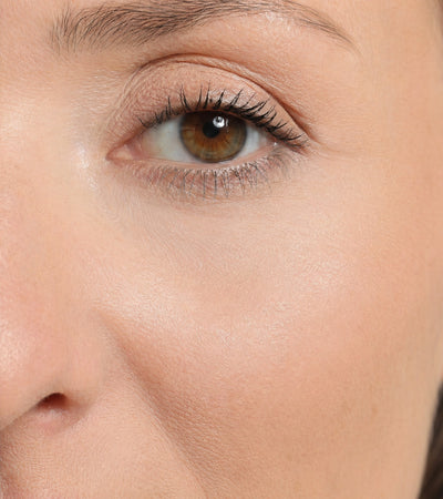 After — Timeliss Foundation